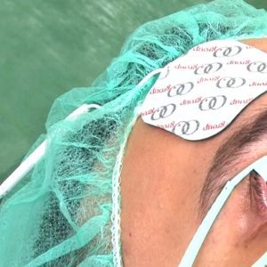 Klebepatch und Kabel für I-ON Iontophorese Generator